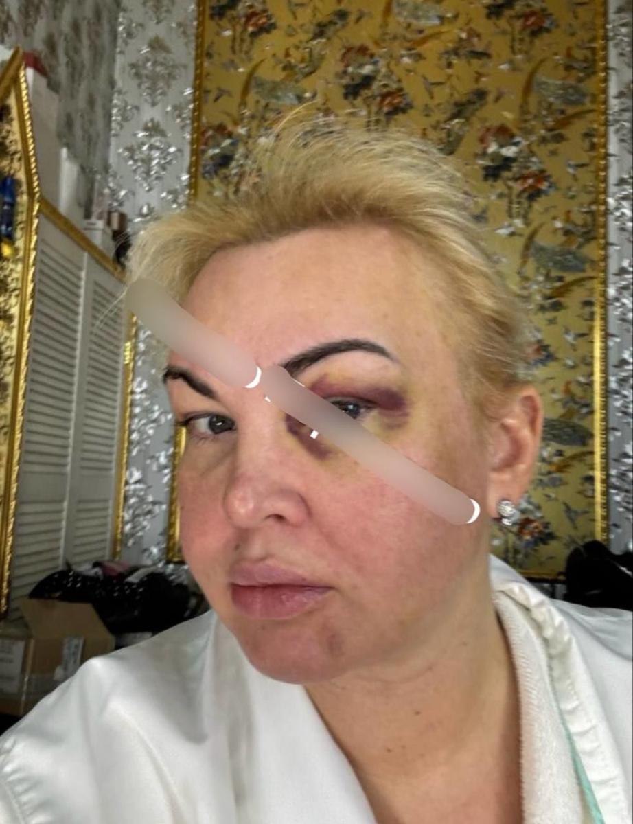 Камалія