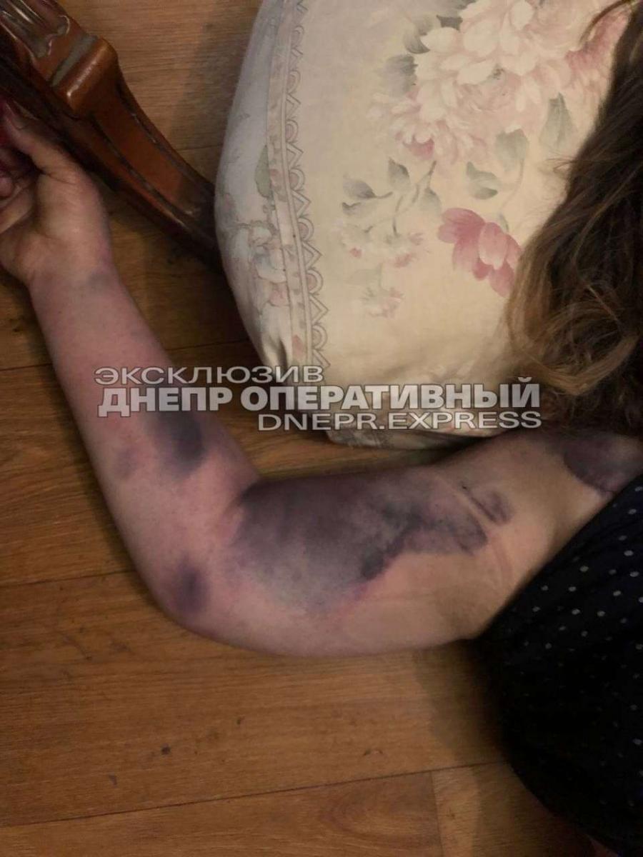 труп