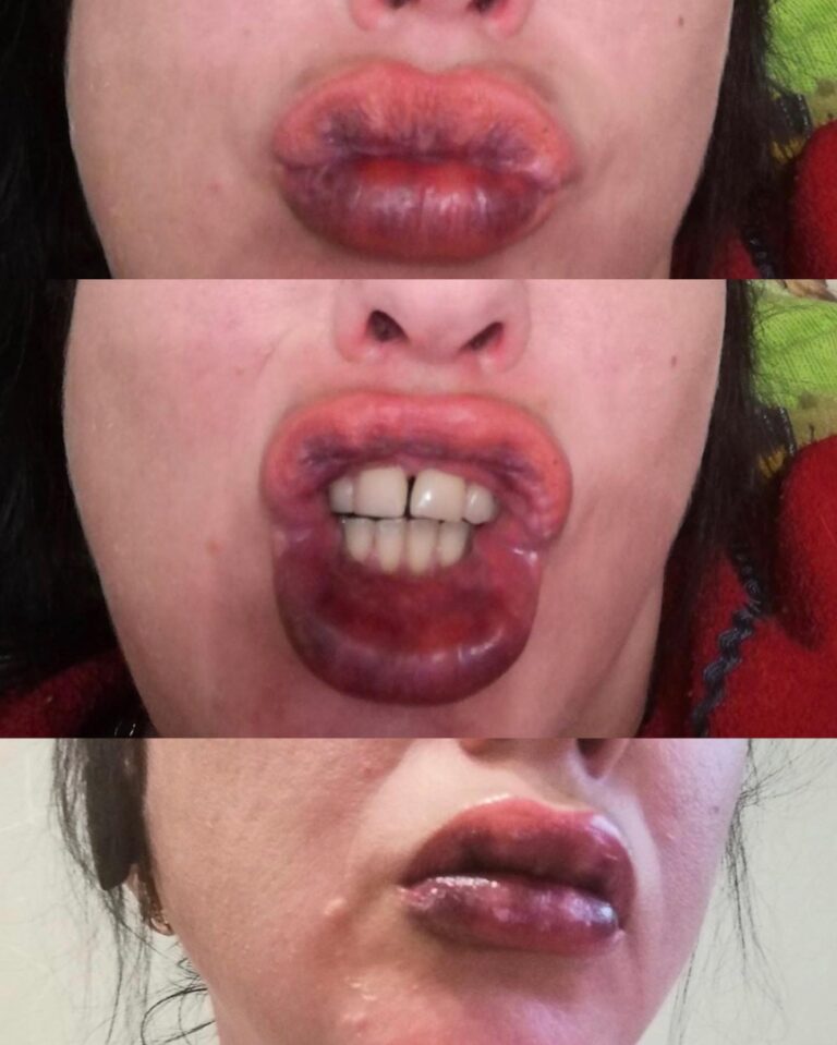 губы