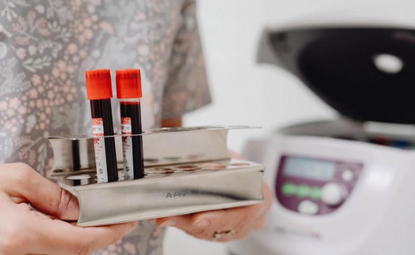 епідемічна ситуація 